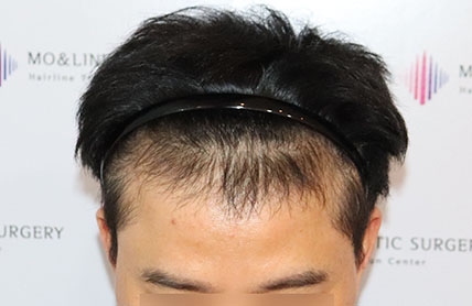 치료후기 이미지